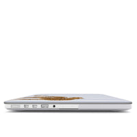 Preppy Cheetah (Blue) MacBook Case